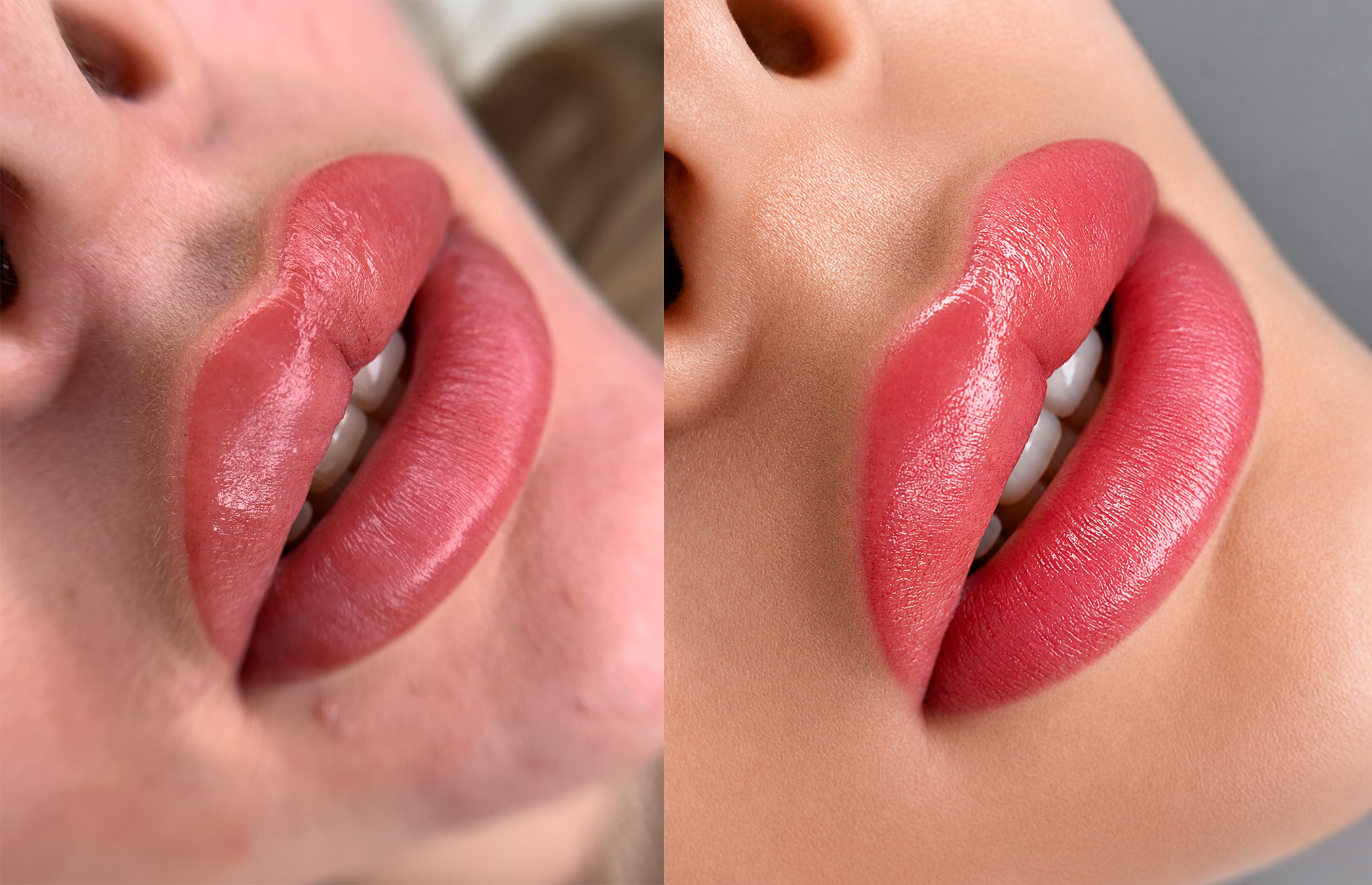 Permanent Retouch